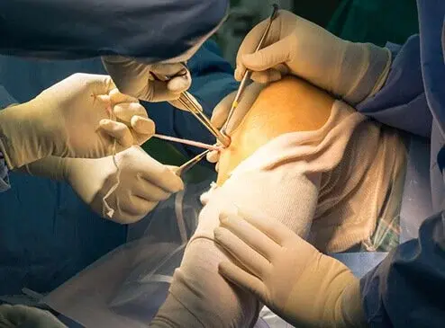Minimally invasive surgery